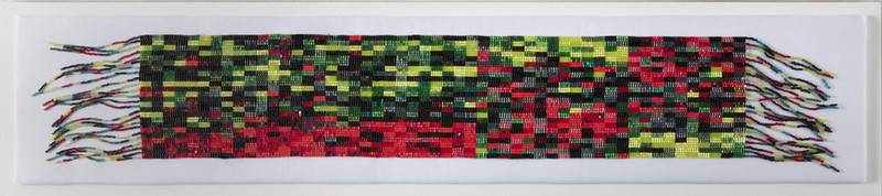 Adrenocortical Cancer (Diabetes Complication), DNA Microarray Analysis